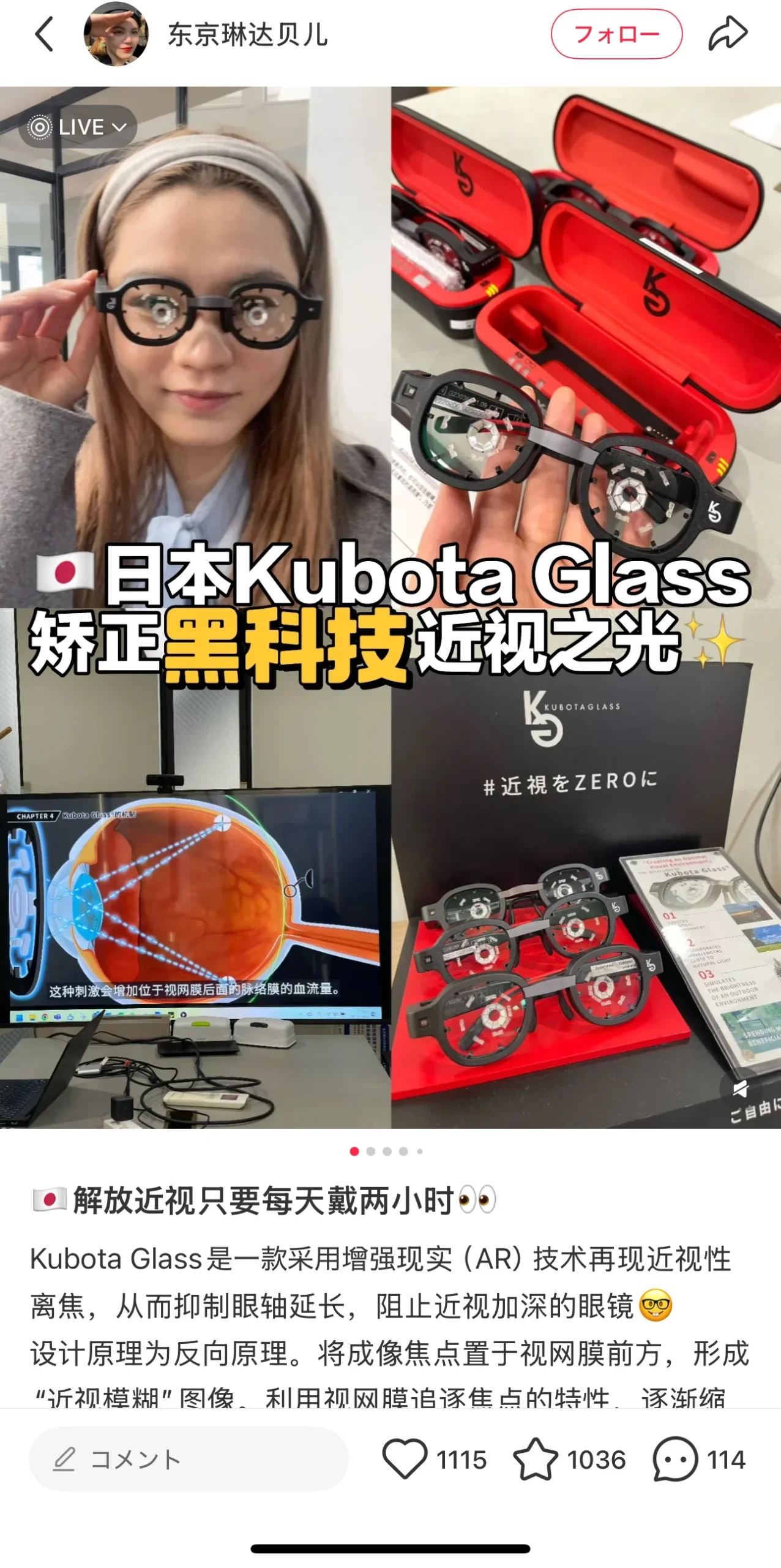 AR近視矯正メガネ投稿が大反響！
